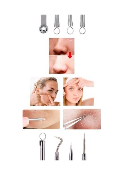 4 Lü Kutulu Paslanmaz Komedon Akne - Siyah Nokta Temizleyici Set fiyatları