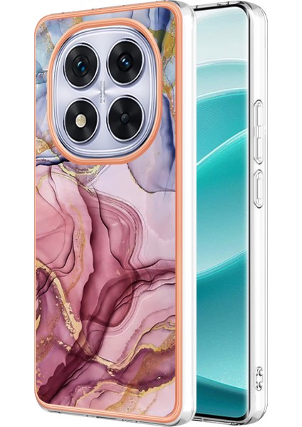 Xiaomi Poco X7 5g/xiaomi Redmi Not 14 Pro 5g Tpu Kılıf Mermer Desen 2.0mm Galvanik Telefon Arka Kapak-Gül Altın (Yurt Dışından)