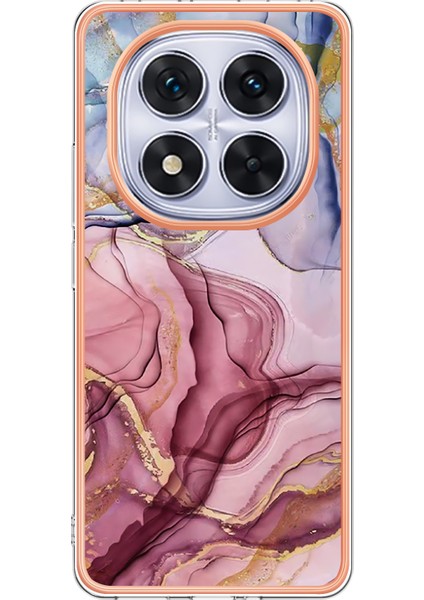 Xiaomi Poco X7 5g/xiaomi Redmi Not 14 Pro 5g Tpu Kılıf Mermer Desen 2.0mm Galvanik Telefon Arka Kapak-Gül Altın (Yurt Dışından)