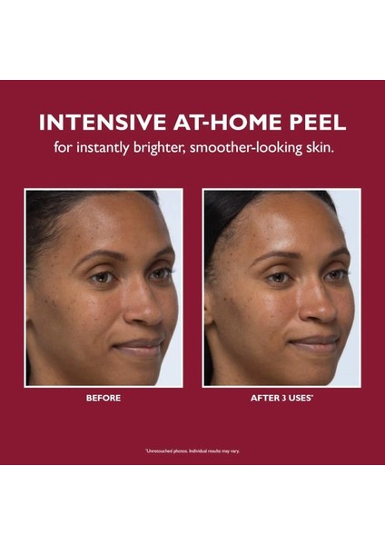 Even Smoother Yüz Peelingi 8 Adet
