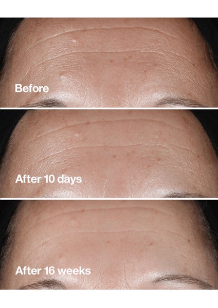 Smart Clinical Repair™ Çizgi ve Kırışıklık Görünümü Karşıtı Serum 30ml | Retinoid, Hyalüronik Asit