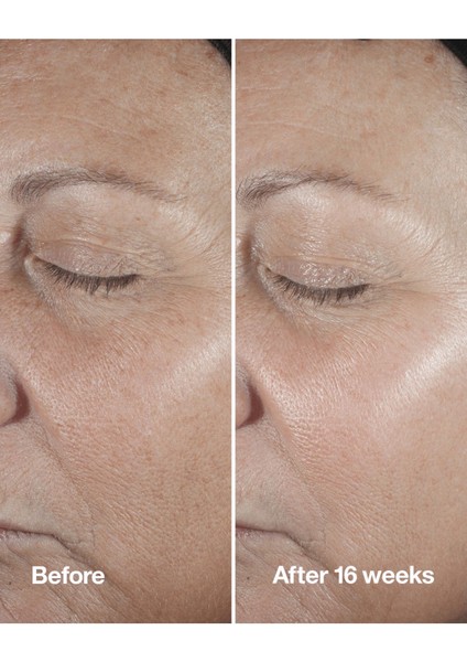 Smart Clinical Repair™ Çizgi ve Kırışıklık Görünümü Karşıtı Serum 30ml | Retinoid, Hyalüronik Asit
