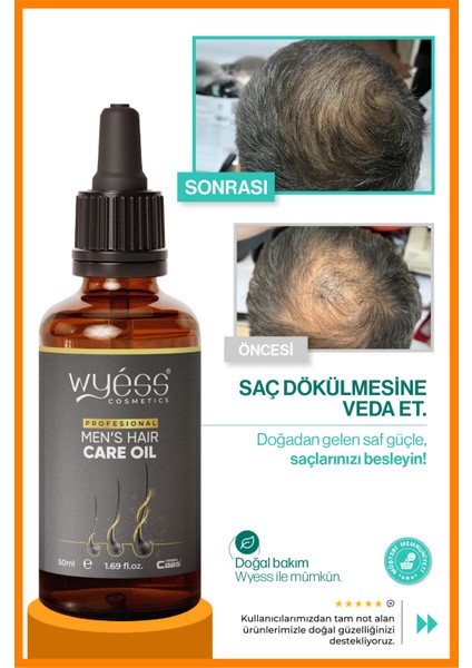 Erkek Saç Bakım Yağı - Saç Çıkarıcı & Besleyici Etki, E & A Vitaminli 50 ml