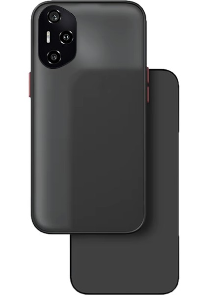 Honor 300 Pro London Serisi Darbeye Dayanıklı Kılıf - Siyah AL3415