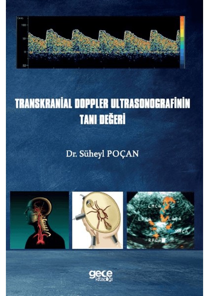 Transkranial Doppler Ultrasonografinin Tanı Değeri - Süheyl Poçan