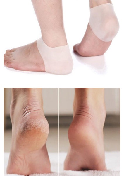 Slikon Topuk Koruması Yarım Çorap Ortopedik Topuk fiyatları