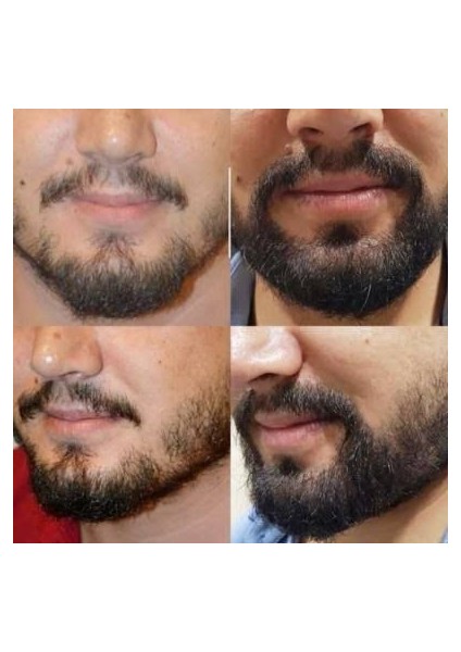 Sakal Serum