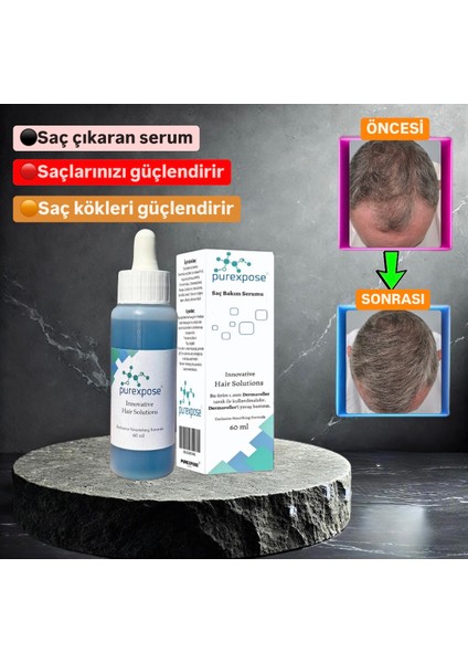 Saç Bakım Serumu & Losyon 1ADET