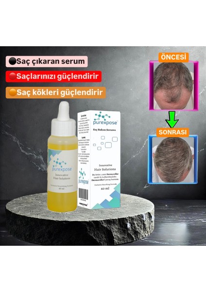 Saç Losyon