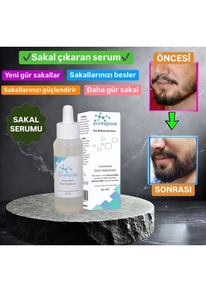 Sakal Serum
