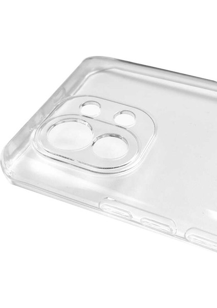 Xiaomi Mi 11 Kılıf Zore Kamera Korumalı Süper Silikon KAPAK-RENKSIZ-8682314125291-TCHS55629 fiyatları