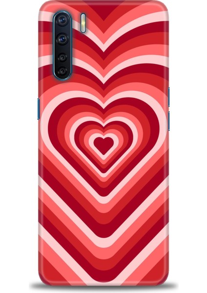 Oppo A91 Ile Uyumlu Hd Baskılı Silikon (Ortasertlikte) Kılıf - 557