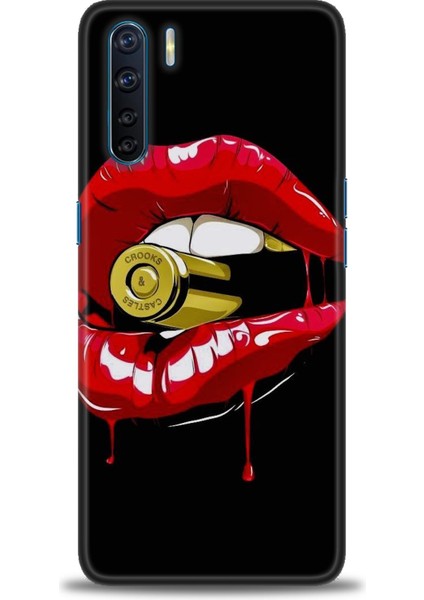 Oppo A91 Ile Uyumlu Hd Baskılı Silikon (Ortasertlikte) Kılıf - 793