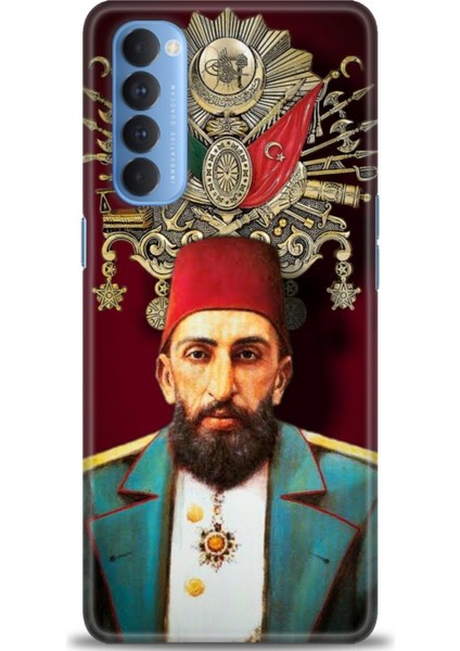 Oppo Reno 4 Pro Ile Uyumlu Hd Baskılı Silikon (Ortasertlikte) Kılıf - 1063