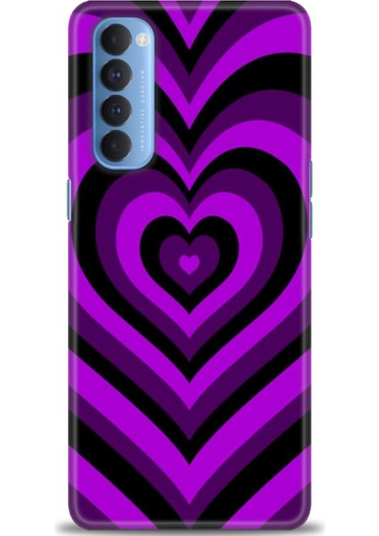 Oppo Reno 4 Pro Ile Uyumlu Hd Baskılı Silikon (Ortasertlikte) Kılıf - 8