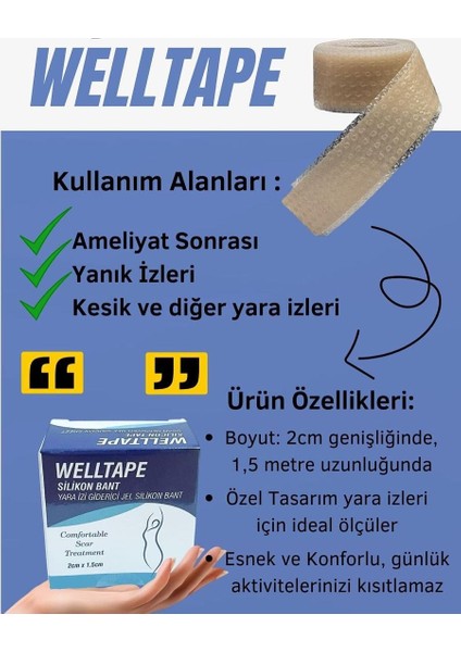 Yaraizi Gidericisilikon Bant 2 Cmx 1,5m