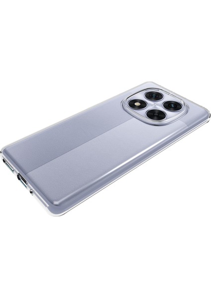 Xiaomi Redmi Için Not 14 Pro 5g/poco X7 5g Şeffaf Telefon Kılıfı Filigrana Dayanıklı Tpu Arka Kapak (Yurt Dışından)