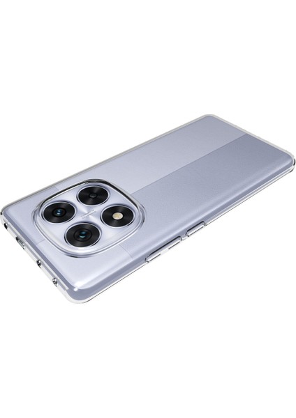 Xiaomi Redmi Için Not 14 Pro 5g/poco X7 5g Şeffaf Telefon Kılıfı Filigrana Dayanıklı Tpu Arka Kapak (Yurt Dışından)