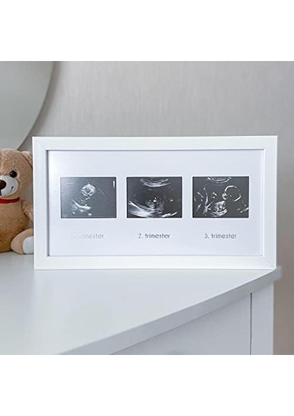 Üçlü Ultrason Anı Çerçevesi - Gebelikte Bebeğin Gelişimini Üç Trimester Anı Olarak Saklayın fiyatları