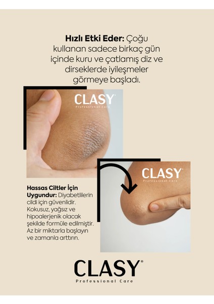 Diz ve Dirsek Bakım Kremi - Çatlak, Kurumuş, Koyulaşmış Sert Deriye Karşı (Clasy Crack Repair Cream) fırsatları