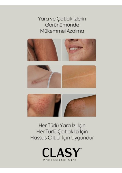 Yara ve Çatlak Izleri Görünümünü Azaltıcı ve Mükemmel Önleyici Krem (Scars & Stretch Marks Cream) modelleri