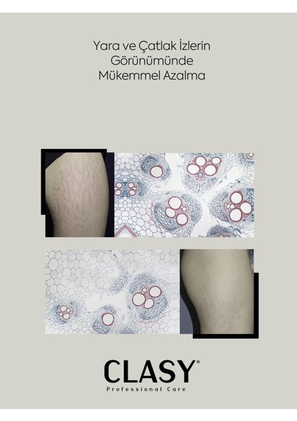 Yara ve Çatlak Izleri Görünümünü Azaltıcı ve Mükemmel Önleyici Krem (Scars & Stretch Marks Cream) indirimleri
