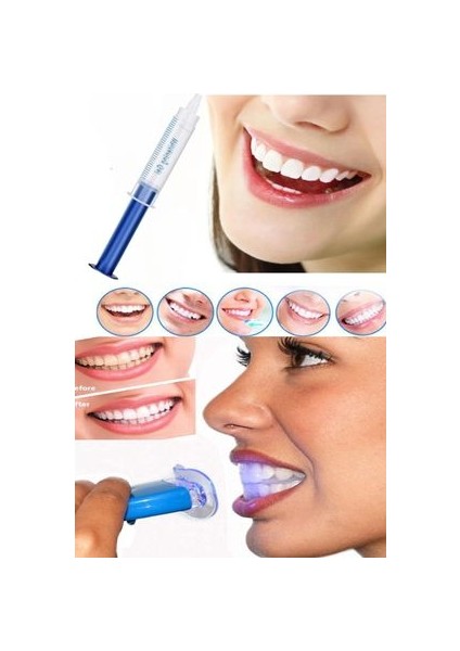 Diş Beyazlatma Jeli Şırıngalı Pratik Kullanım (1 Şırınga 1 Cihaz) LED Işıklı Diş Beyazlatma fiyatları
