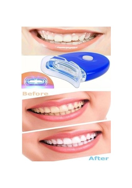 Diş Beyazlatma Jeli Şırıngalı Pratik Kullanım (1 Şırınga 1 Cihaz) LED Işıklı Diş Beyazlatma modelleri