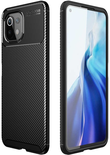 Xiaomi Mi 11 Lite Kılıf Zore Negro Silikon KAPAK-SIYAH-8682314113649-OTNV52664