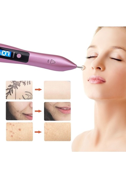 Profesyonel Plasma Pen Cihazı Plazma Spot Pen Plexr Cihazı Dijital 9 Level fırsatları