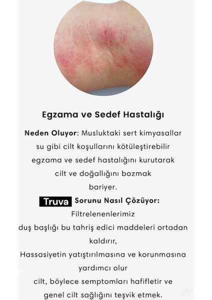 Lüks Model Siyah 5 Fonksiyonlu Duş Başlığı Kireç Önleyici Özellikli