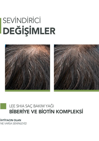 Biberiye Ve Biotin Kompleksi 50 Ml - Yıpranmış Ve Dökülen Saçlar Için Hızlı Uzatıcı Saç Bakım Yağı