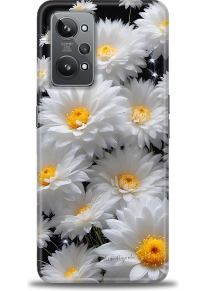 Realme Gt2 Ile Uyumlu Hd Baskılı Kılıf - 2884