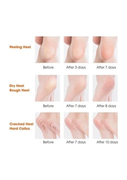 Silikon Topuk Nemlendirici Çorap fırsatları