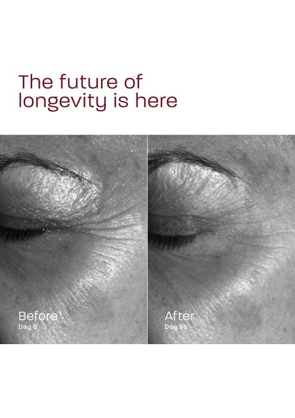 Genesıs Formula Intensıve Treatment 30 ml