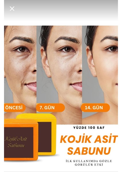 Kojik Asit Içeren Zerdeçal Sabunu Gözenek Peeling Etkili Temizleme Arındırıcı modelleri
