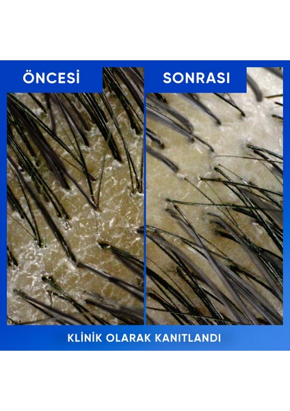 Elma Sirkesi Arındırma ve Parlaklık Şampuan 330MLX3