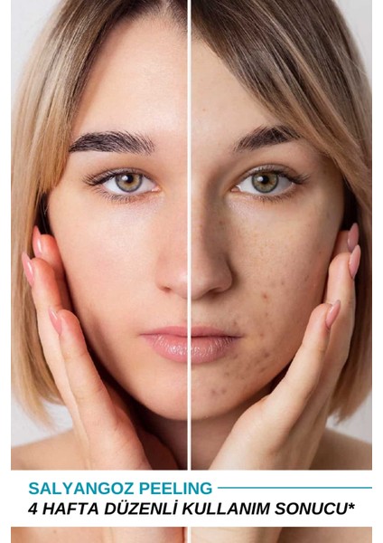 Salyangoz Özlü Cilt Soyucu, Yenileyici ve Canlandırıcı Peeling Jel - Yüz ve Vücut Kullanımı fırsatları
