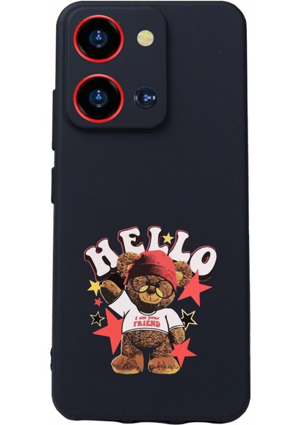 Luxury S19 Max Pro S Zoom Uyumlu Kamera Korumalı ve Tasarımlı Siyah Renk Silikon Kılıf 1 Adet
