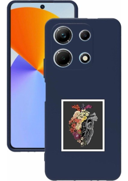 Luxury Note 30 Baskılı ve Kamera Korumalı Lacivert Renk Silikon Kılıf 1 Adet