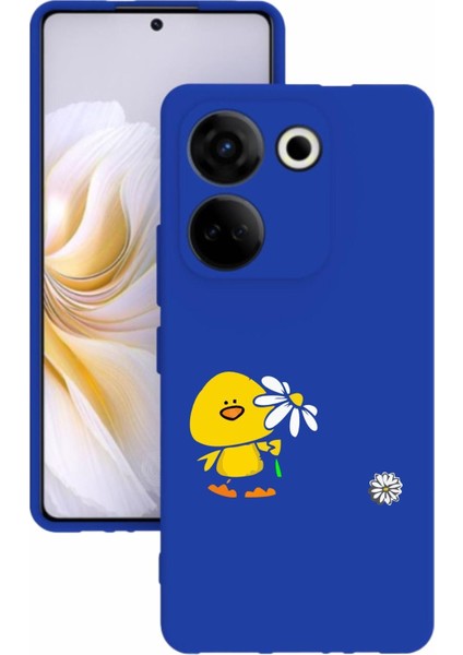 Luxury Camon 20 Pro Kamera Korumalı ve Tasarımlı Mavi Renk Silikon Kılıf 1 Adet