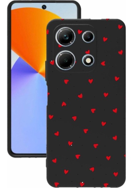 Luxury Note 30 Baskılı ve Kamera Korumalı Siyah Renk Silikon Kılıf 1 Adet