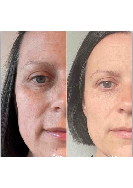Novage+Lift+Firm Rutine Rich Botoks Yapan Set indirimleri