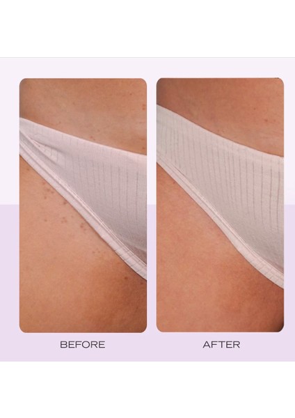 Ingrown Hair Pads - Batık Tüyler Için Biyolojik Olarak Bozunabilen Diskler X60 fırsatları