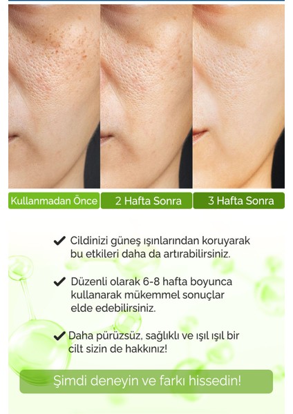Sérum Réducteur De Pores 30 ml