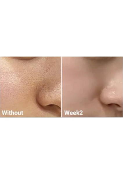 Medıcube Zero Pore Toner (Gözenek Karşıtı Tonik)(Globalcare) modelleri