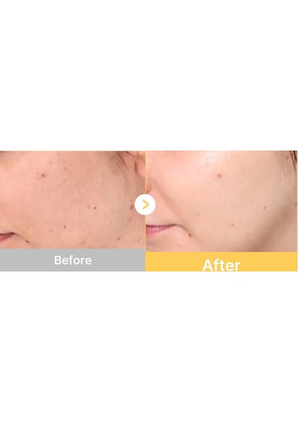 - Kojic Acid Turmeric Brightening Gel Mask(Aydınlatıcı Jel Maske)(Globalcare) modelleri