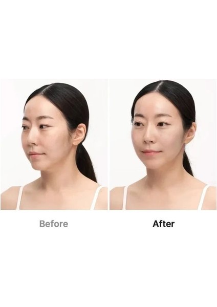 - Age-R Ultra Tune (Globalcare) indirimleri