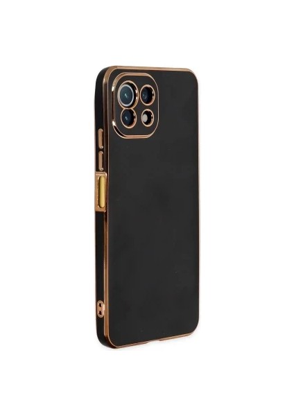 Xiaomi Mi 11 Lite Kılıf – Asmobıle Şanzelize Silikon Kapak, Ince Yapı, Kaymaz Mat Doku, Tam Koruma