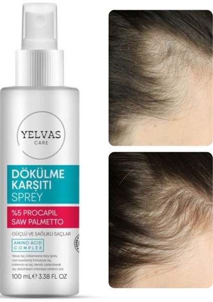 Procapil 5% ve Saw Palmetto Saç Dökülmesine Karşı Güçlendirici Sprey (Serum) 100 ml